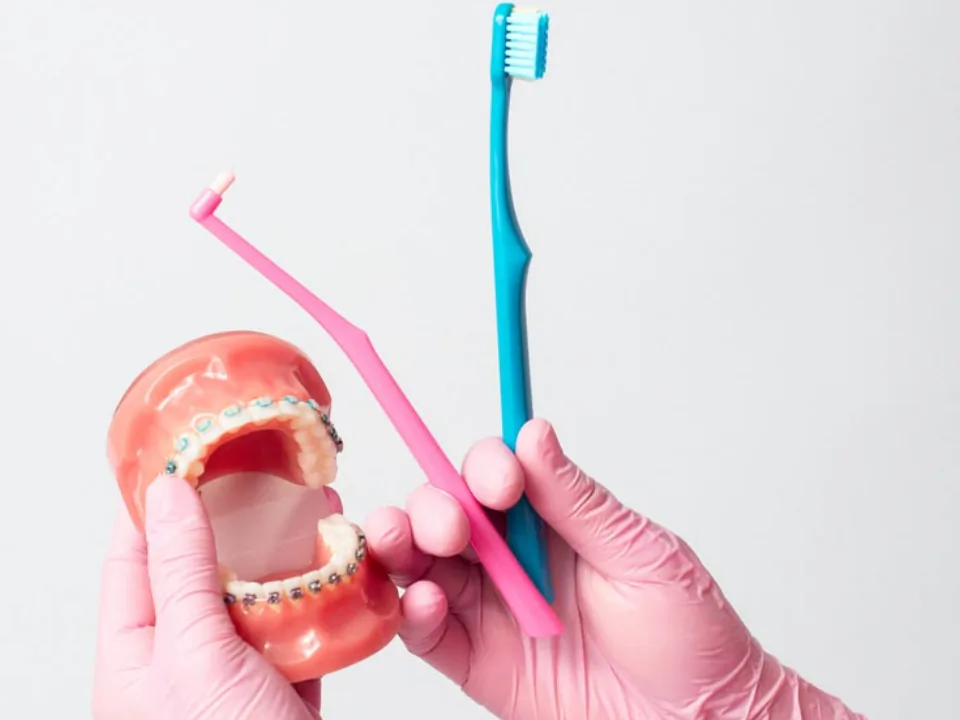 Cepillo dental y cepillo interdental junto a un modelo de ortodoncia.