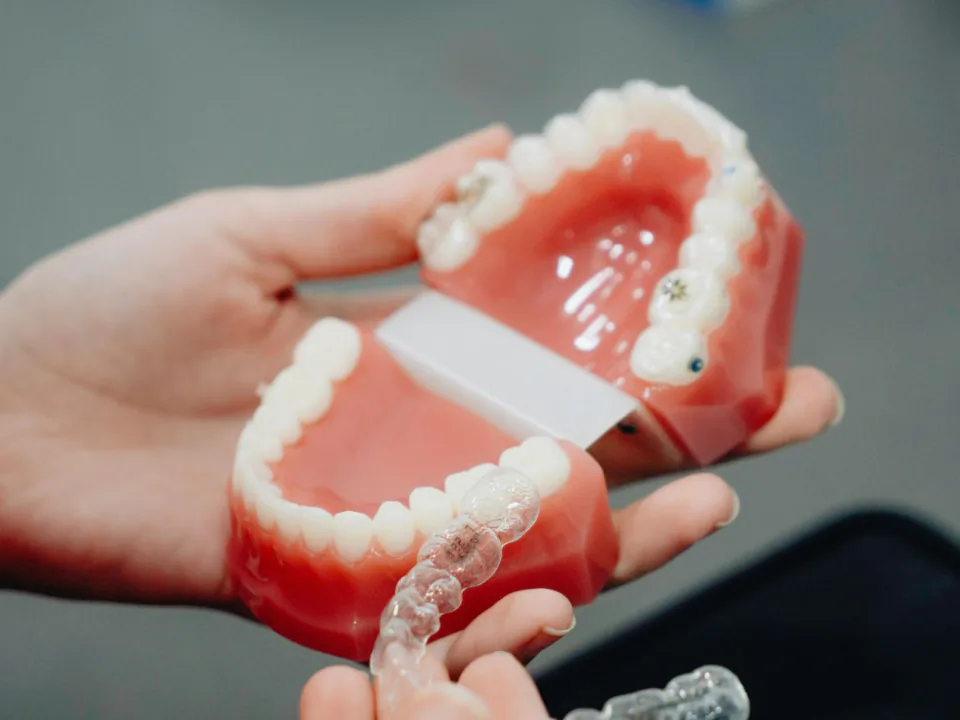 Profesional mostrando un alineador transparente sobre un modelo dental.