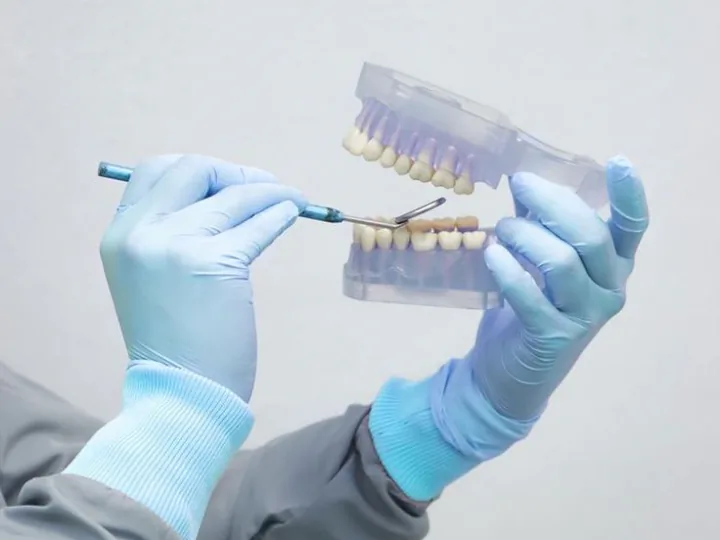 Profesional valorando un modelo dental para planificar una prótesis.